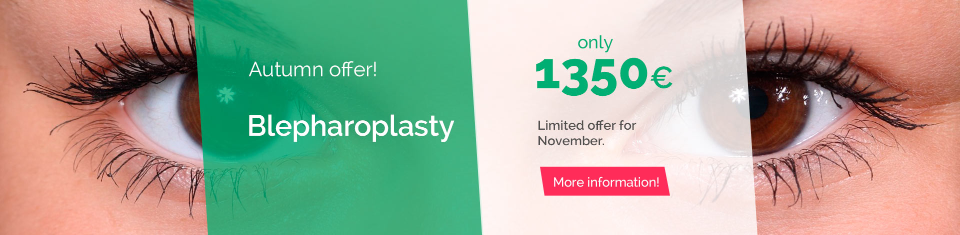 blepharoplasty offer