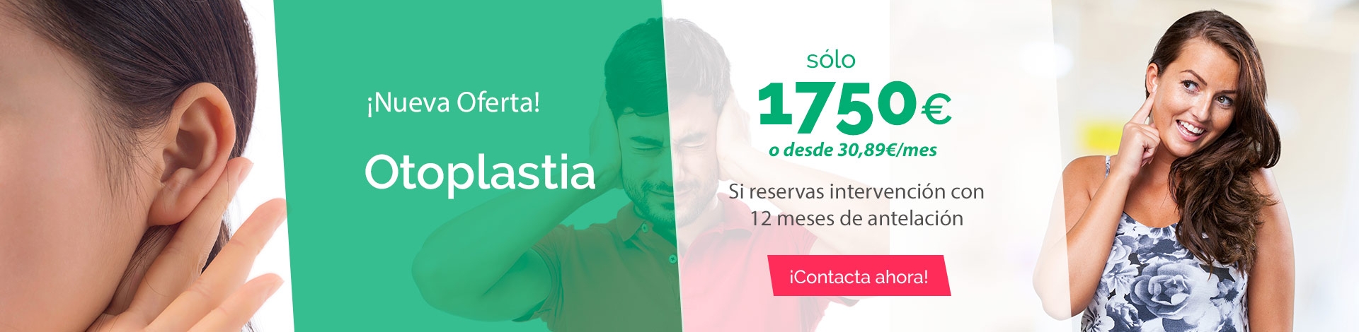 Otoplastia Otoplastia