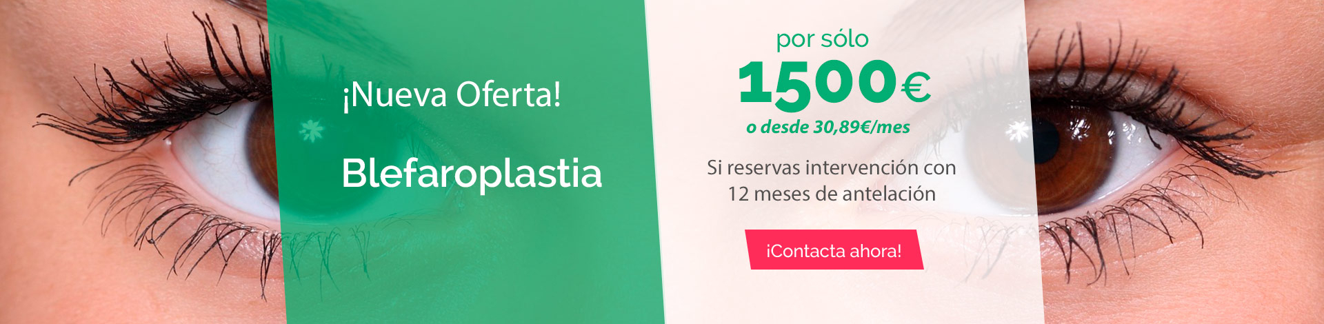 blefaroplastia cirugia de parpados blefaroplastia cirugia de parpados